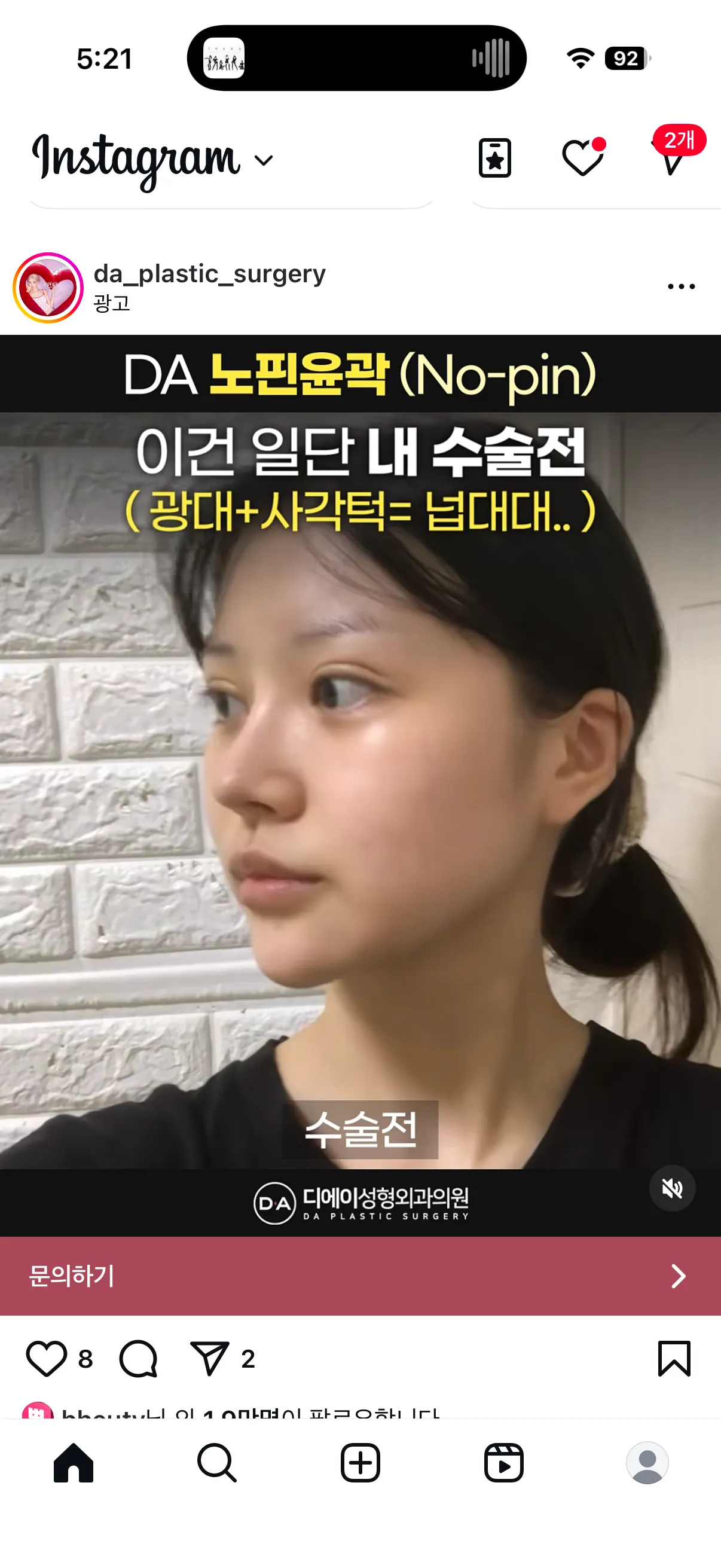 윤곽 핀고정 안해도 안위험한가요?