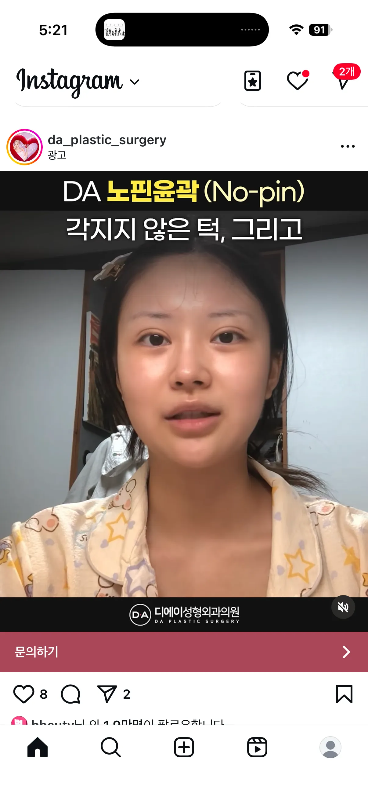 윤곽 핀고정 안해도 안위험한가요?2