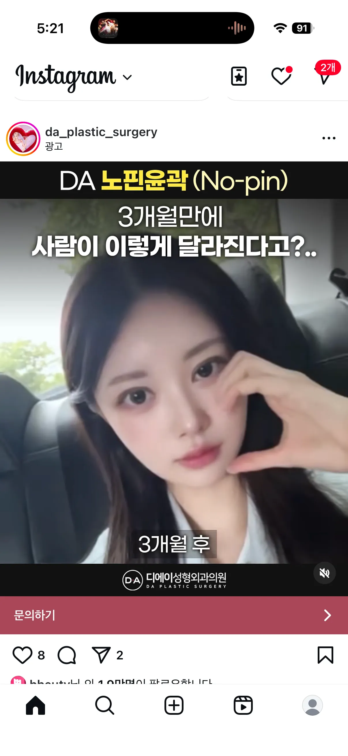 윤곽 핀고정 안해도 안위험한가요?3