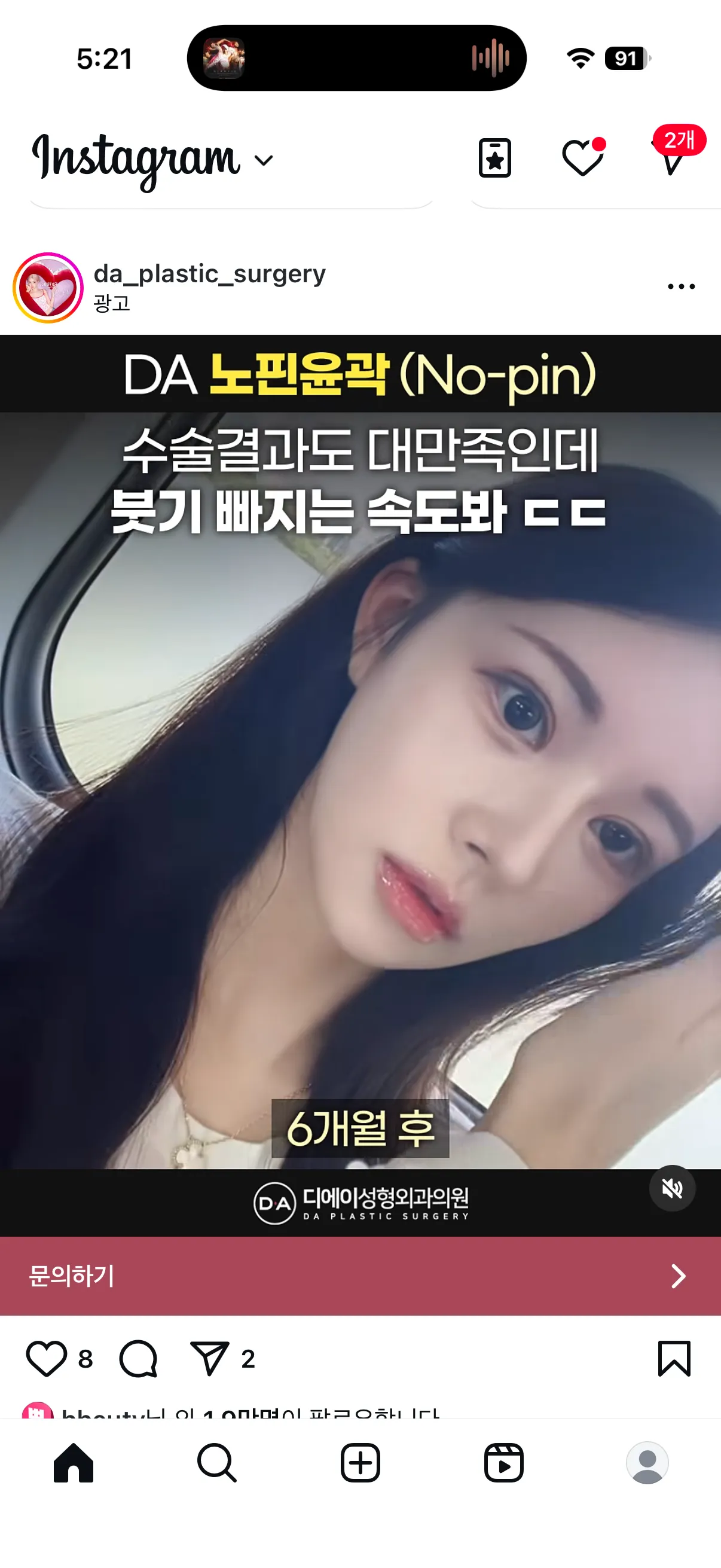 윤곽 핀고정 안해도 안위험한가요?4