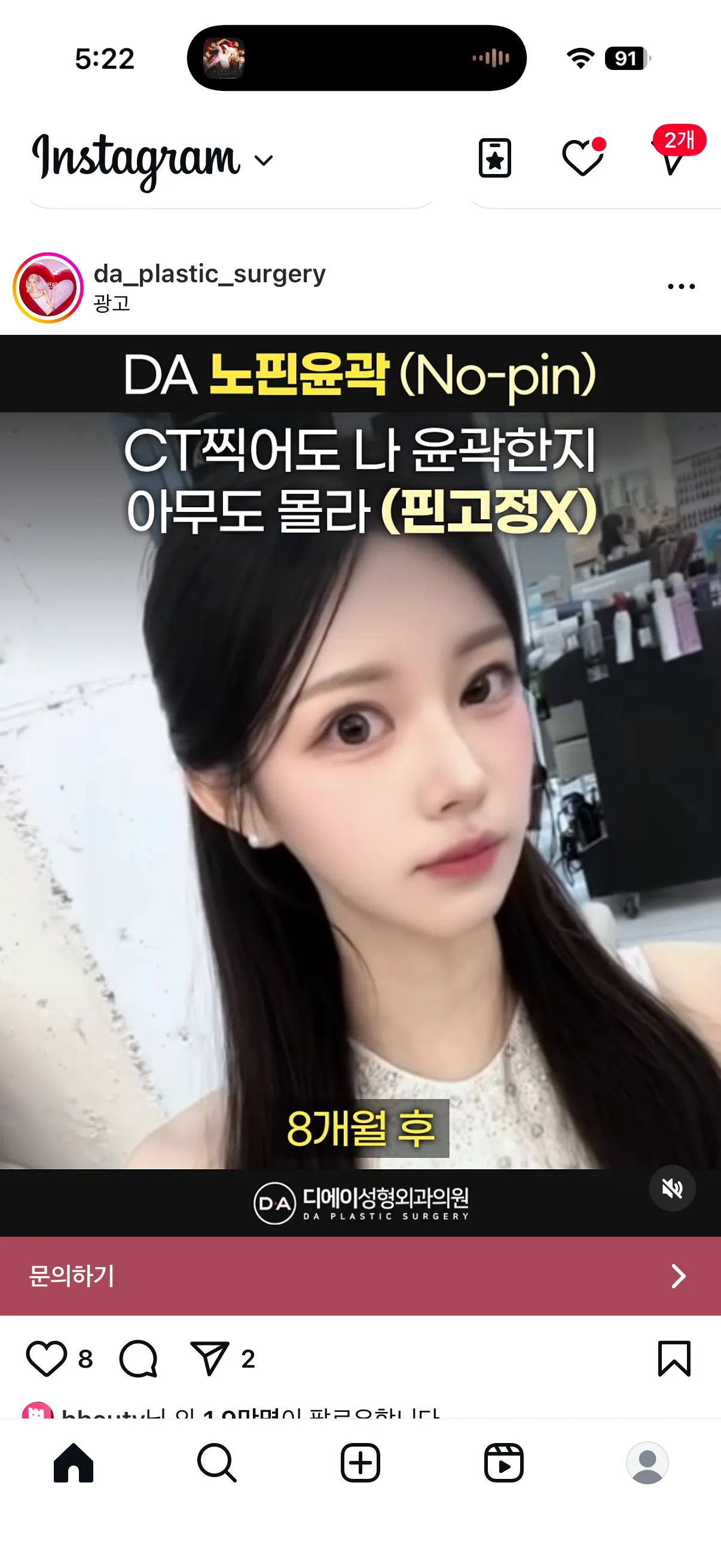윤곽 핀고정 안해도 안위험한가요?5