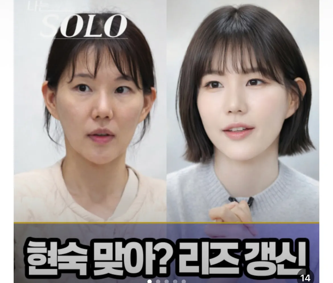 시술 모햇을까요?