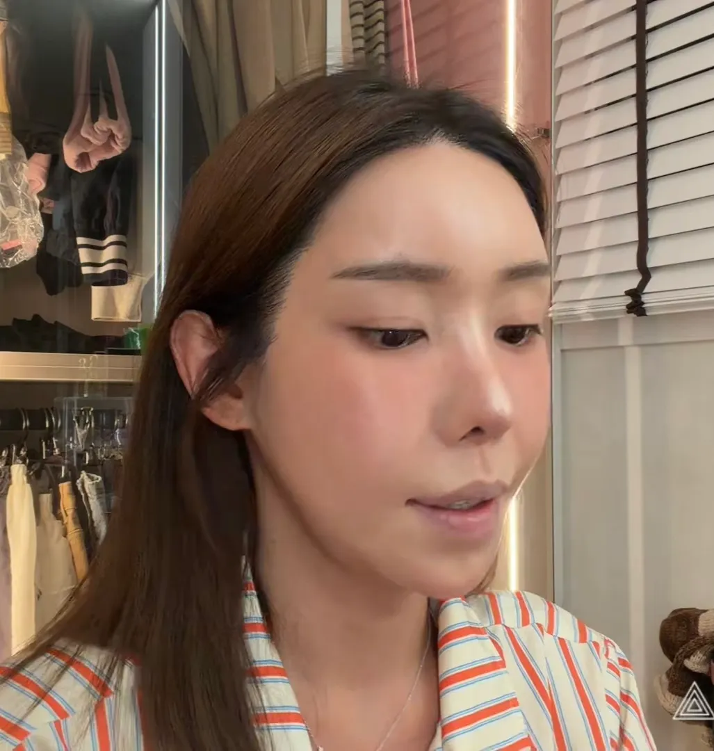 헤어라인 모발이식 추천이에여??