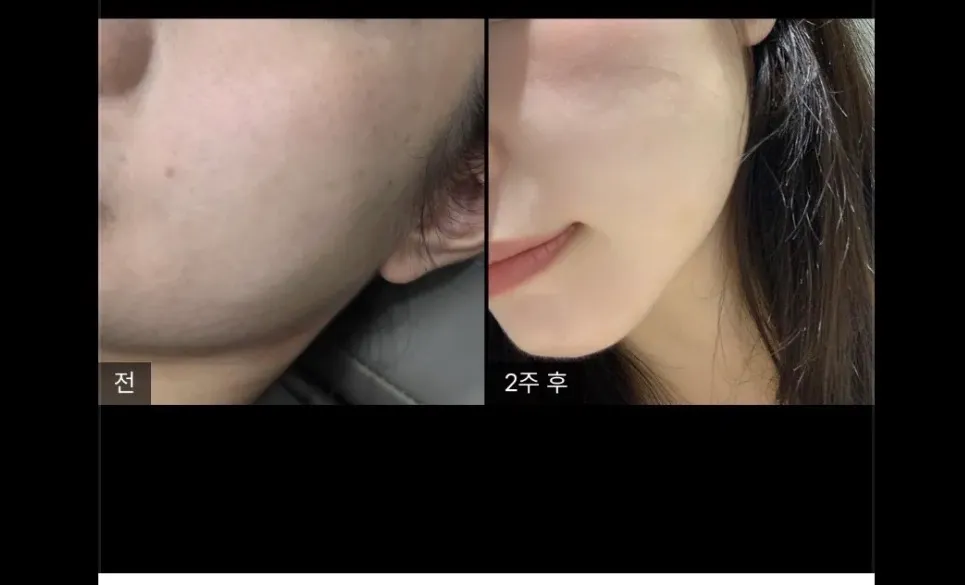 언니들 리투오 어디가 잘해요?? 제발 한번만 HELP 진짜 이게 되나요..