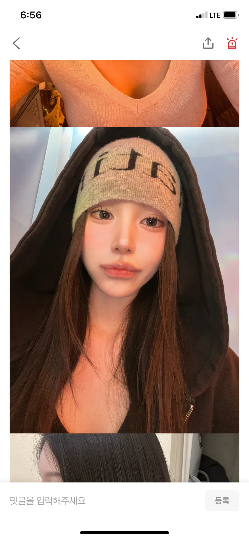 강남언니 코후술 후기 여자