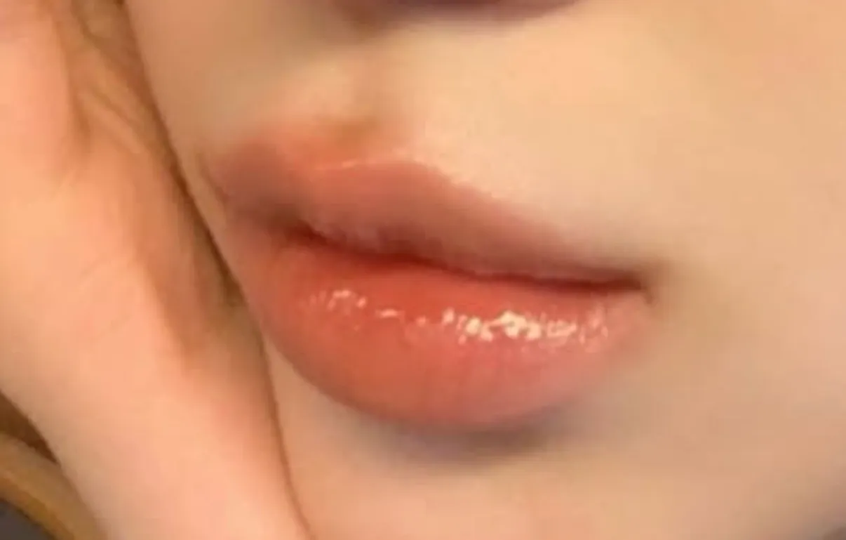 듀입술시른데 입필병원 어디가야돼요?? 언니들 도움한번만... 이번주 팁방 기원할게여...