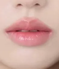 듀입술시른데 입필병원 어디가야돼요?? 언니들 도움한번만... 이번주 팁방 기원할게여...2