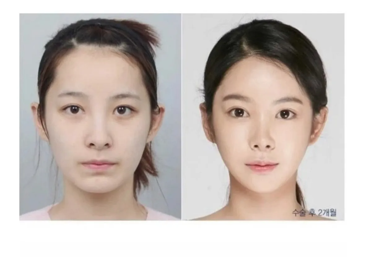 이거 댓글