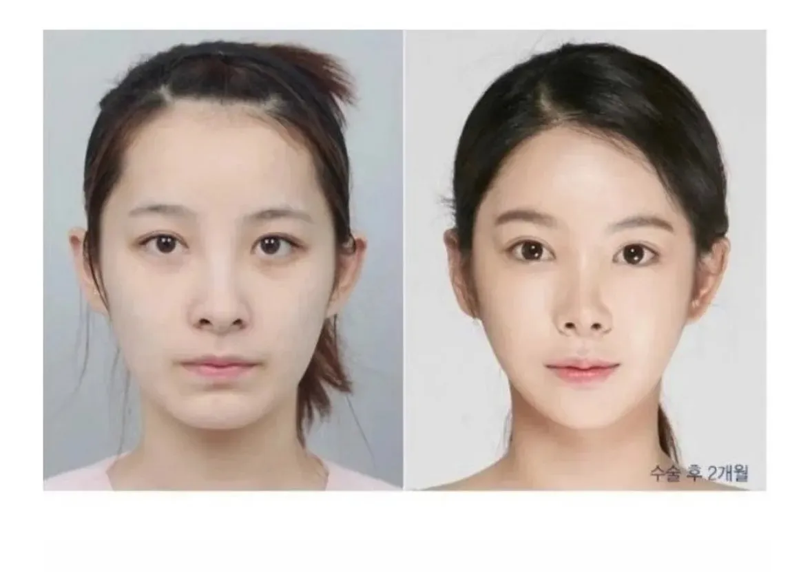 언니들 이거 연옌 누구 생각나여?