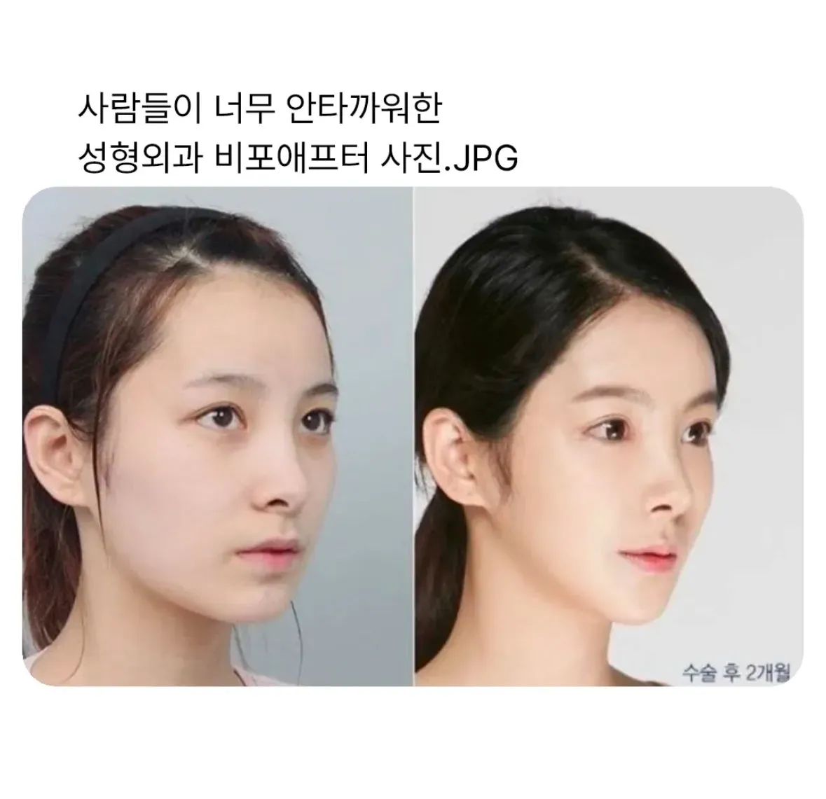 언니들 이거 연옌 누구 생각나여?2