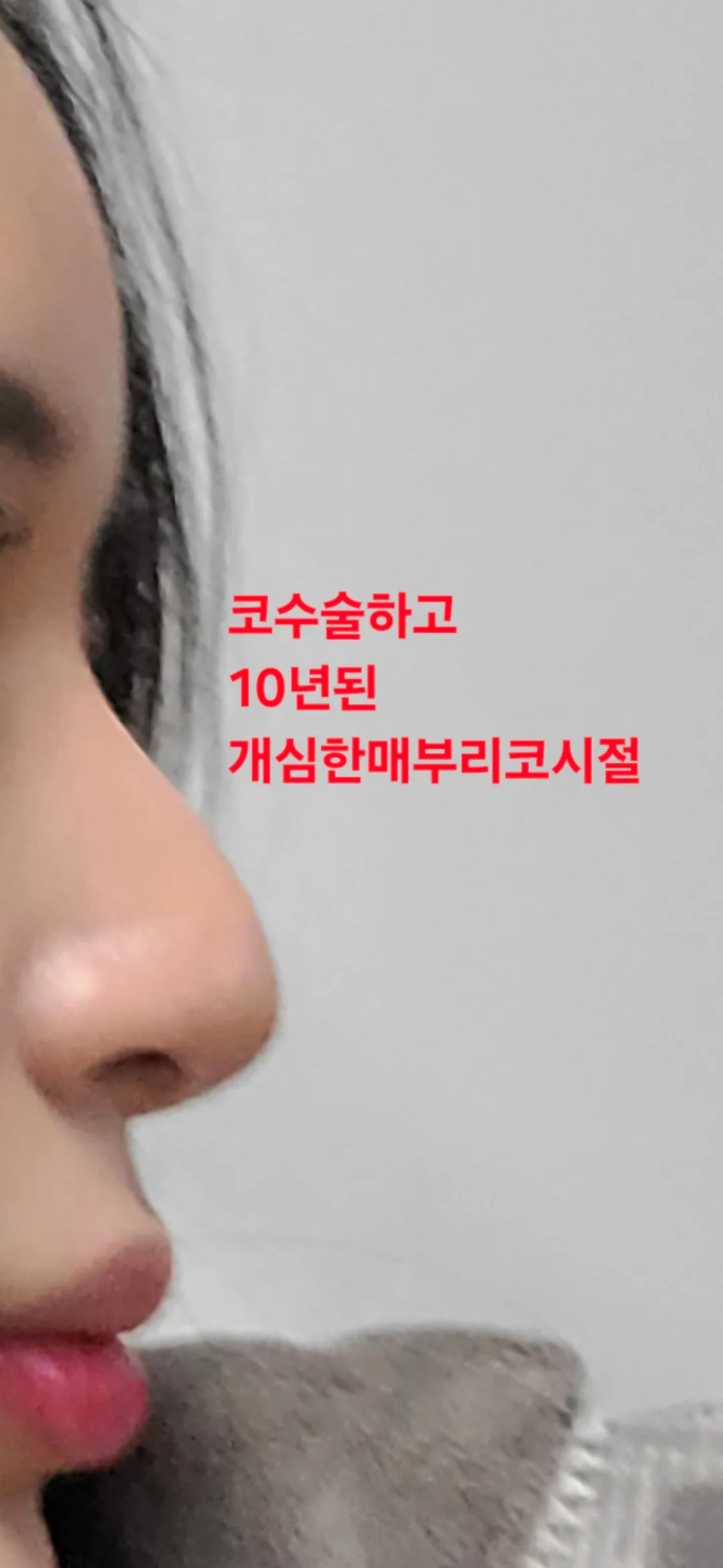 코필러 다시 맞을때 된거같죠? 답바랍니다