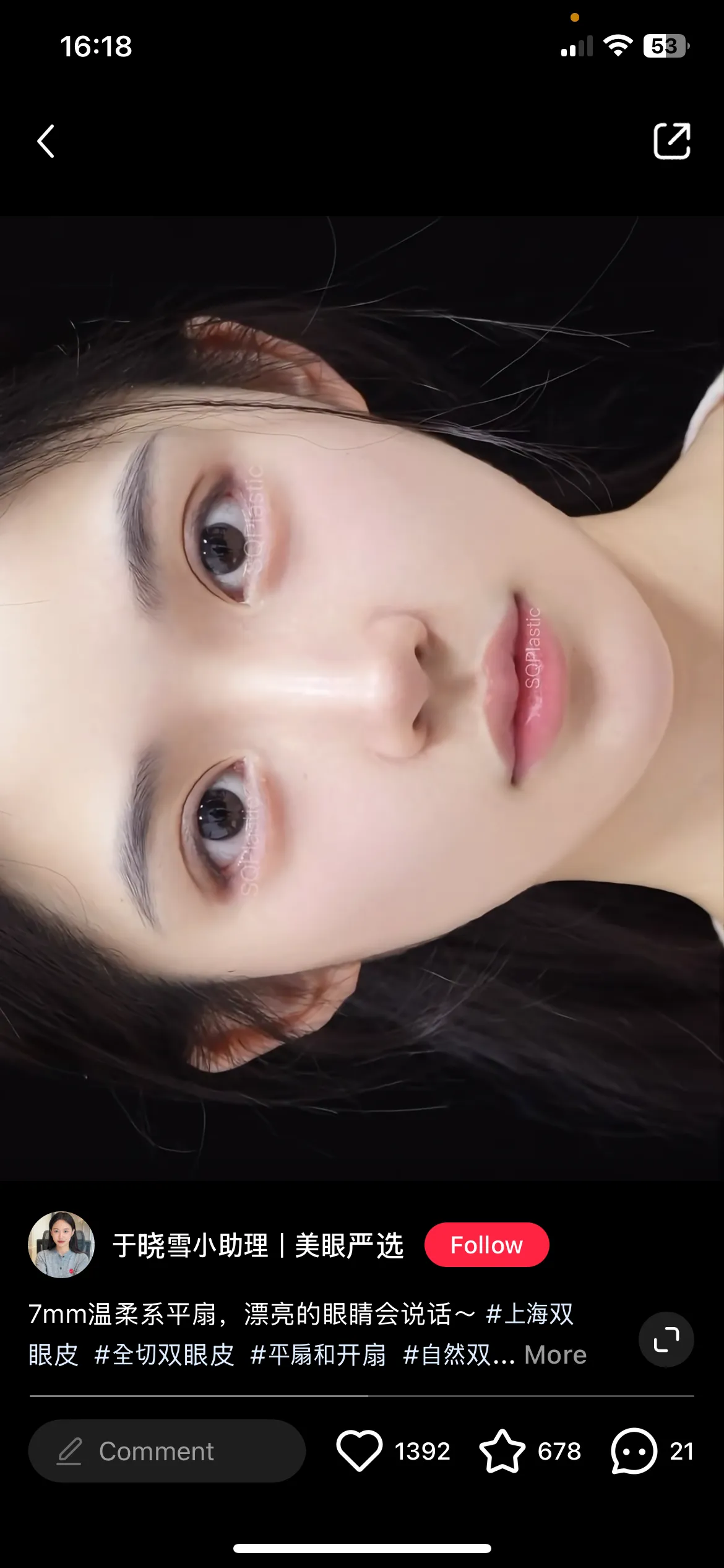 쌍수 일케만 돠면 좋겟다