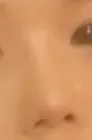 이거 성형코 일까용??3