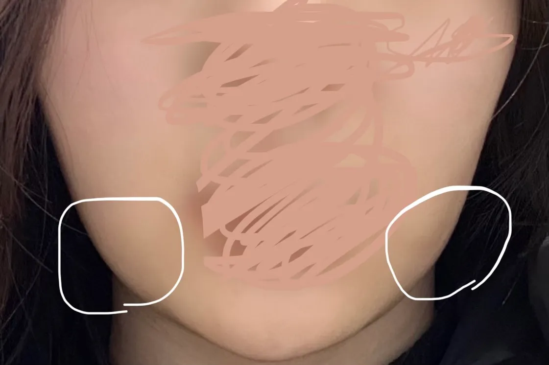 이건뭘받아야할가요..