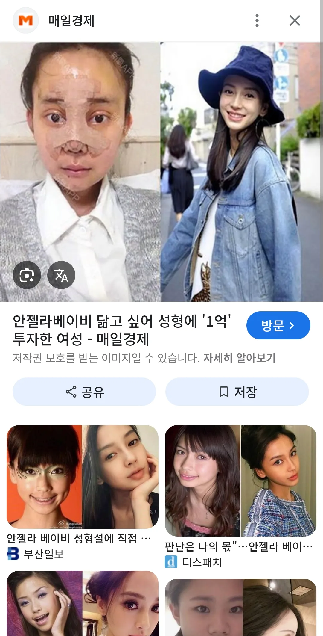 짱깨들성형잘하네3