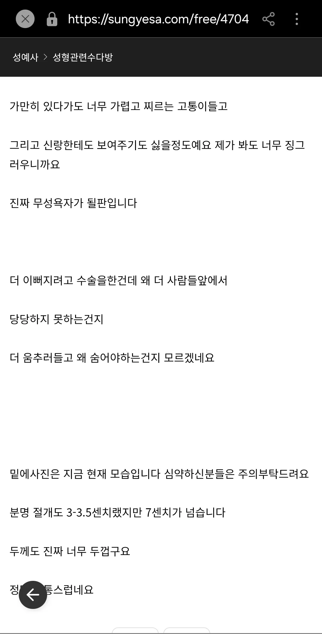 이분어떡하냐 가슴성형밑절흉 1위다...3