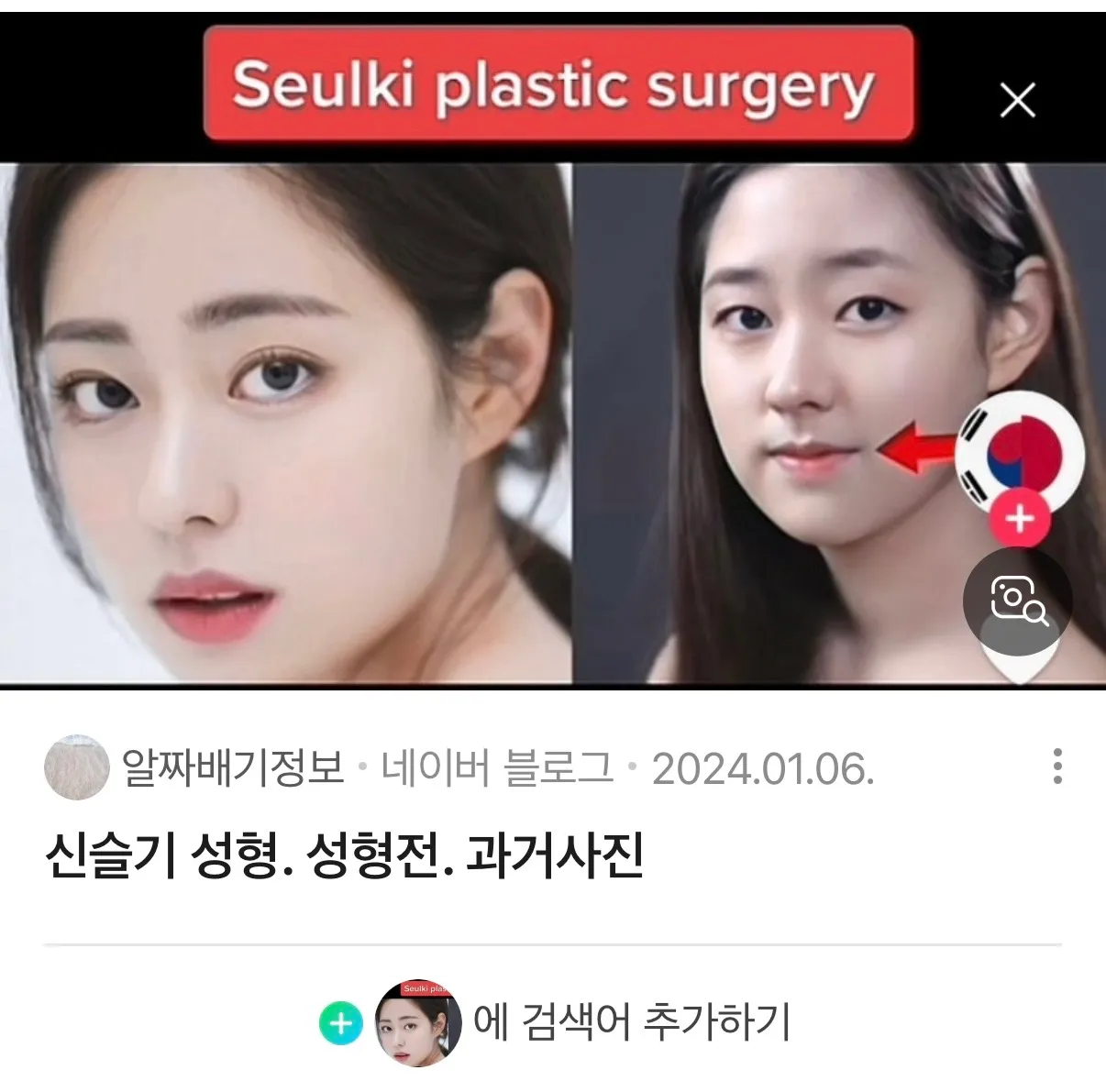 신슬기 입술 턱 비대칭 댓글