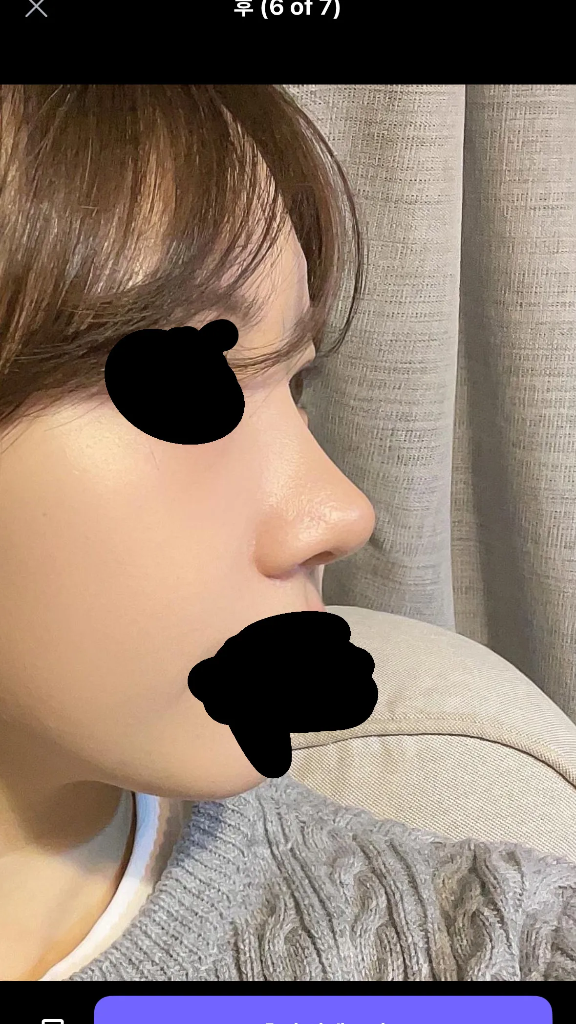 코 미감 어때용2