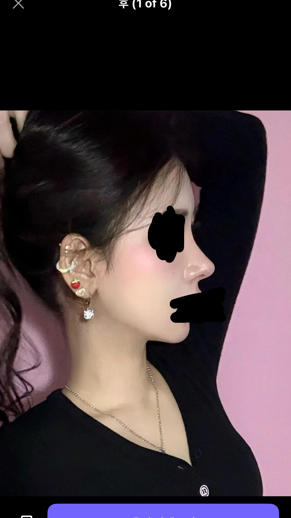 코 미감 어때용5
