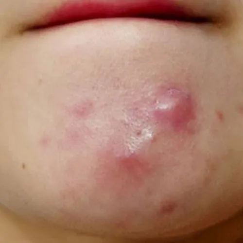 혐짤주의 턱에 이렇게 주기적으로 올라오ㅓ요
