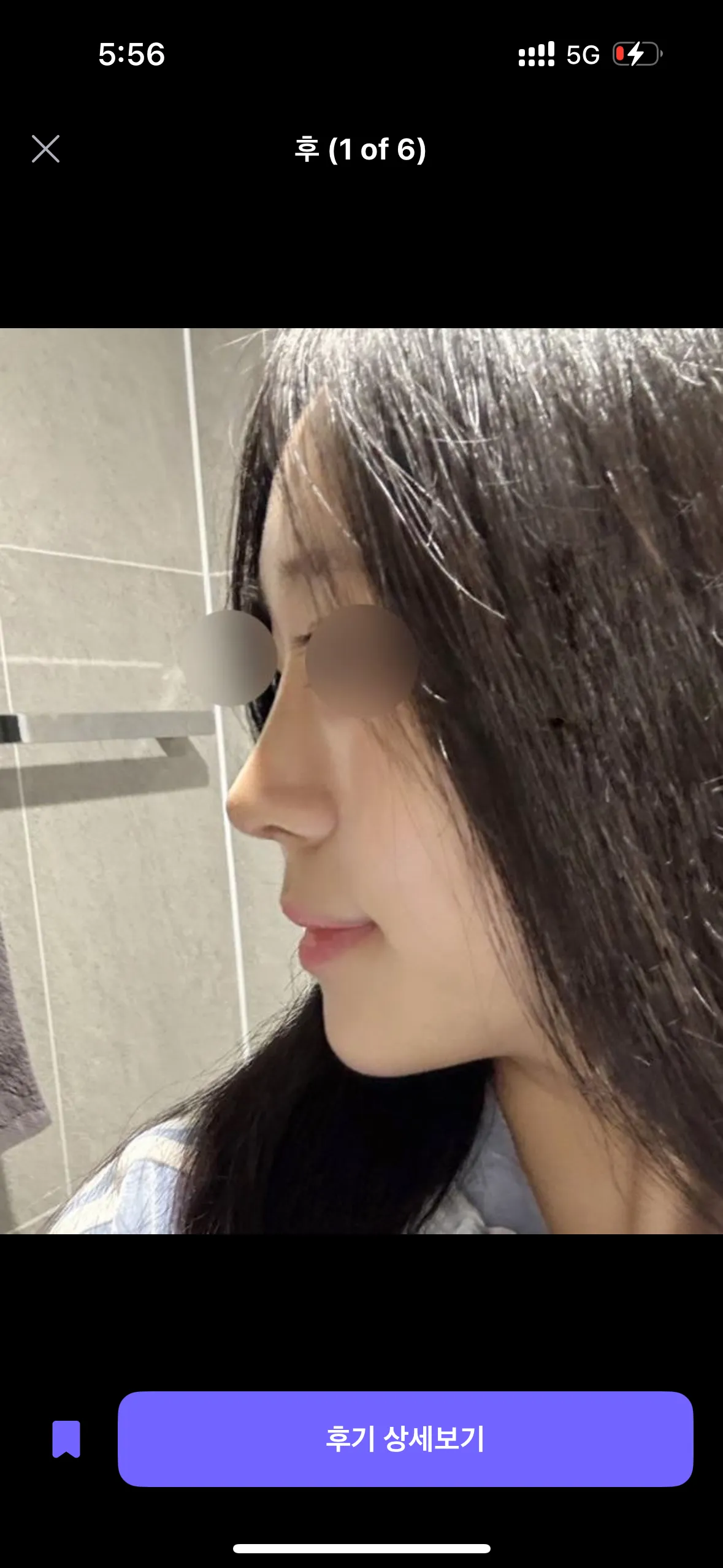 코 어디가 나아요?