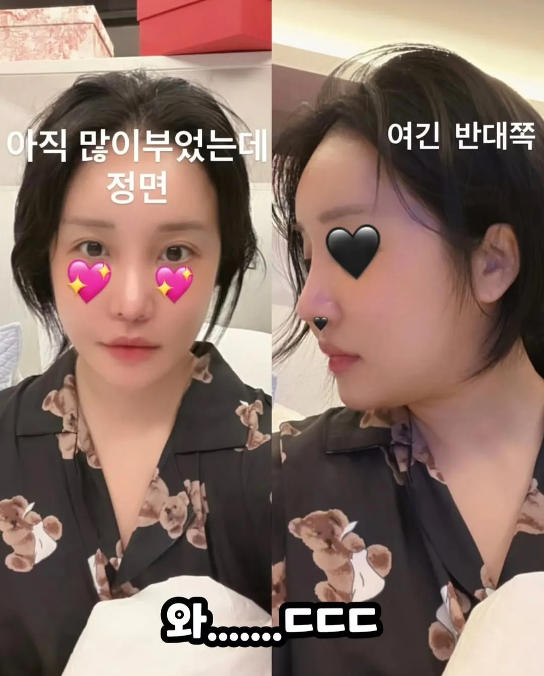 랄랄