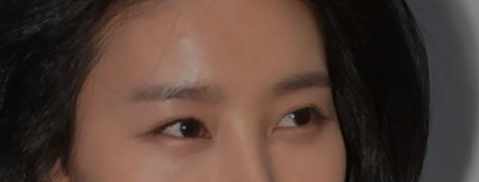 이런 눈 트임할까요 말까요