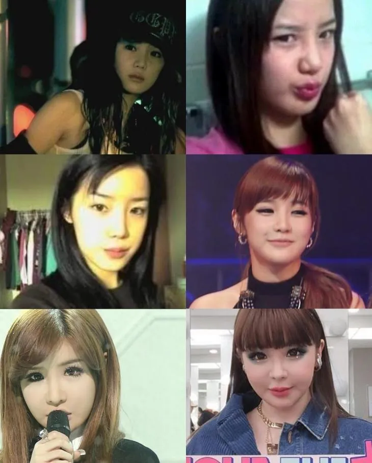 얘옆에서 누가 성형하라고 조종하는건가