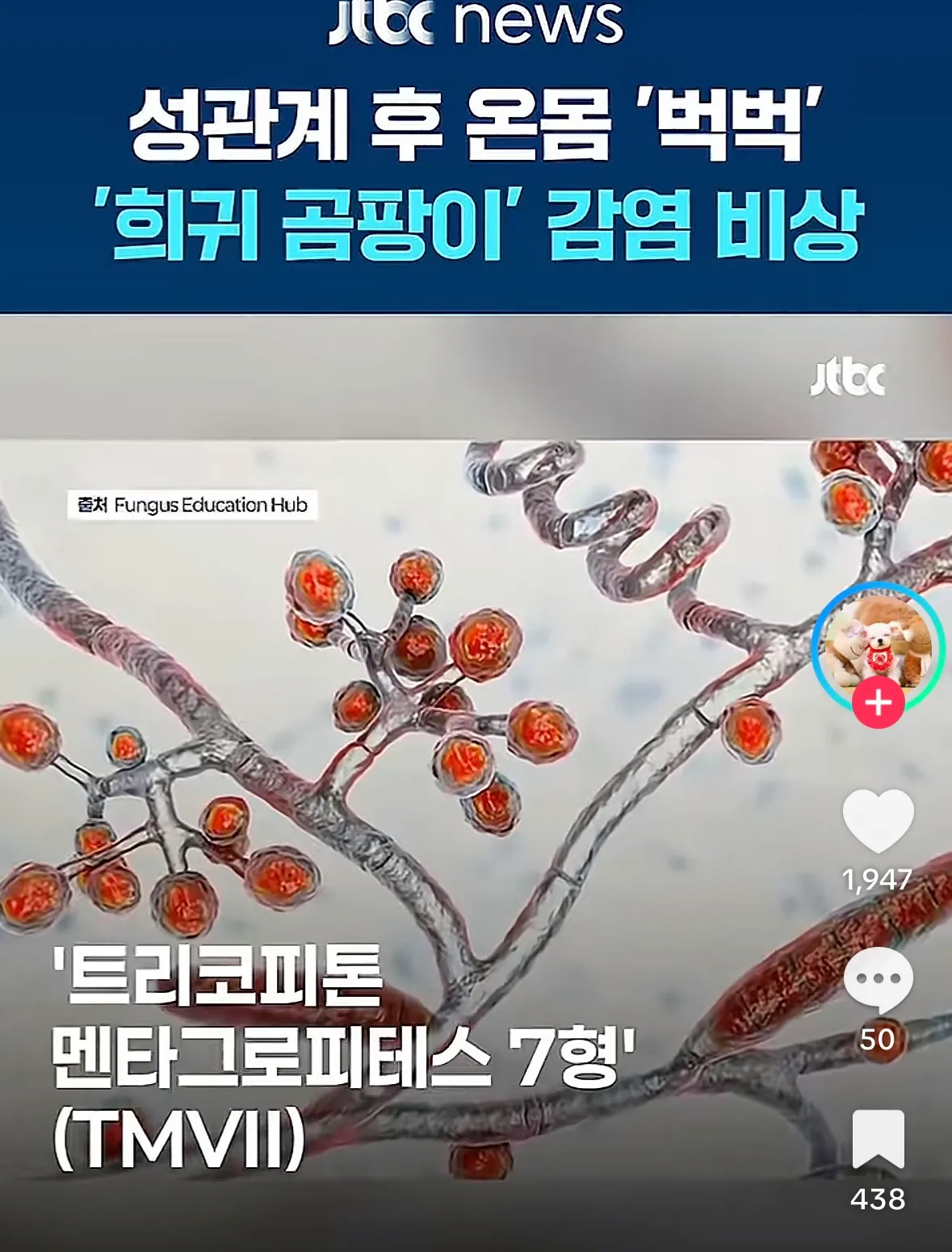 개무섭네여