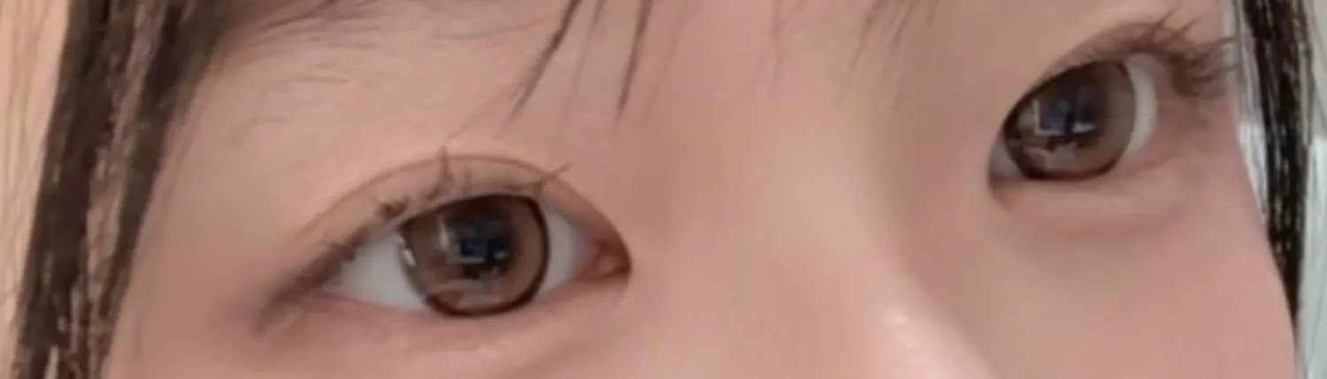 눈 라인 댓글