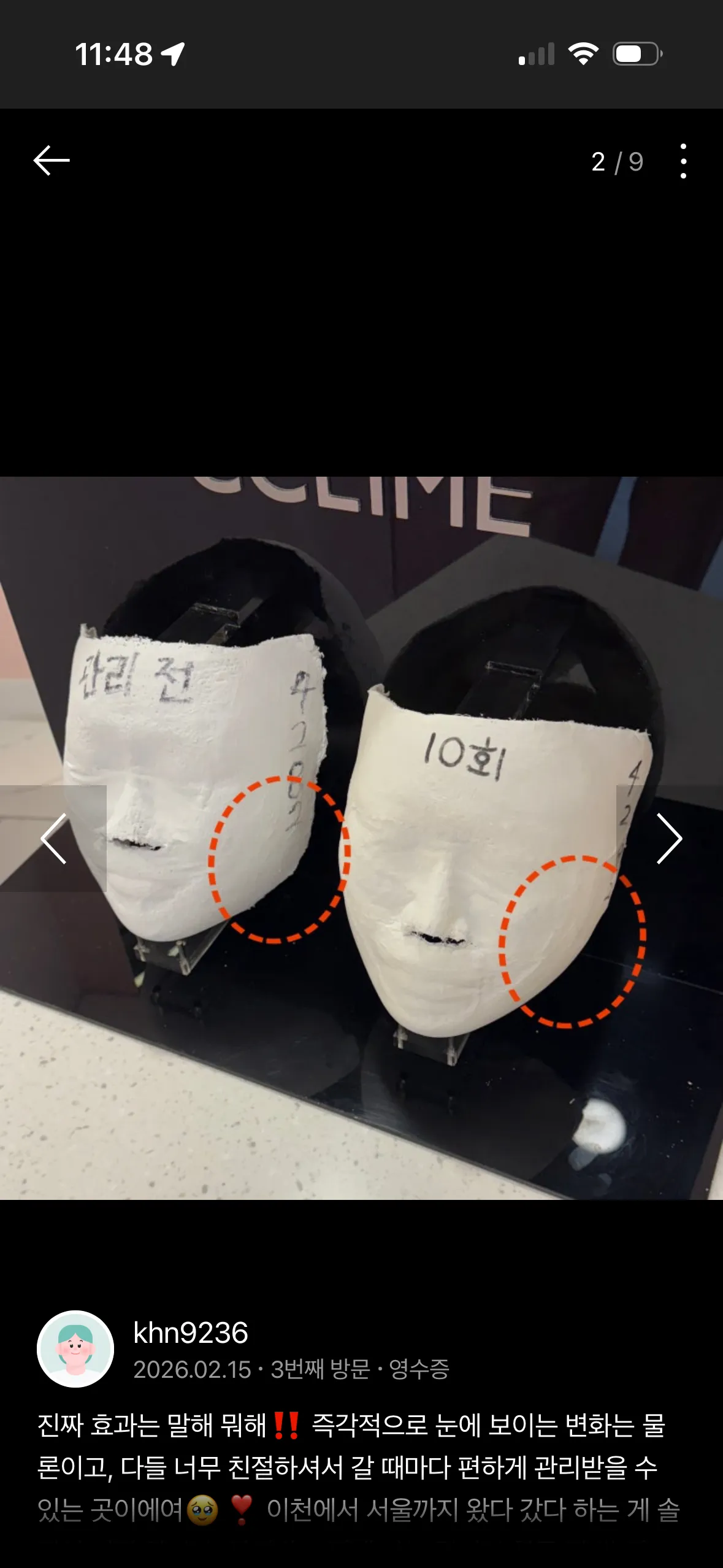 경락 진짜 효과있나요?
