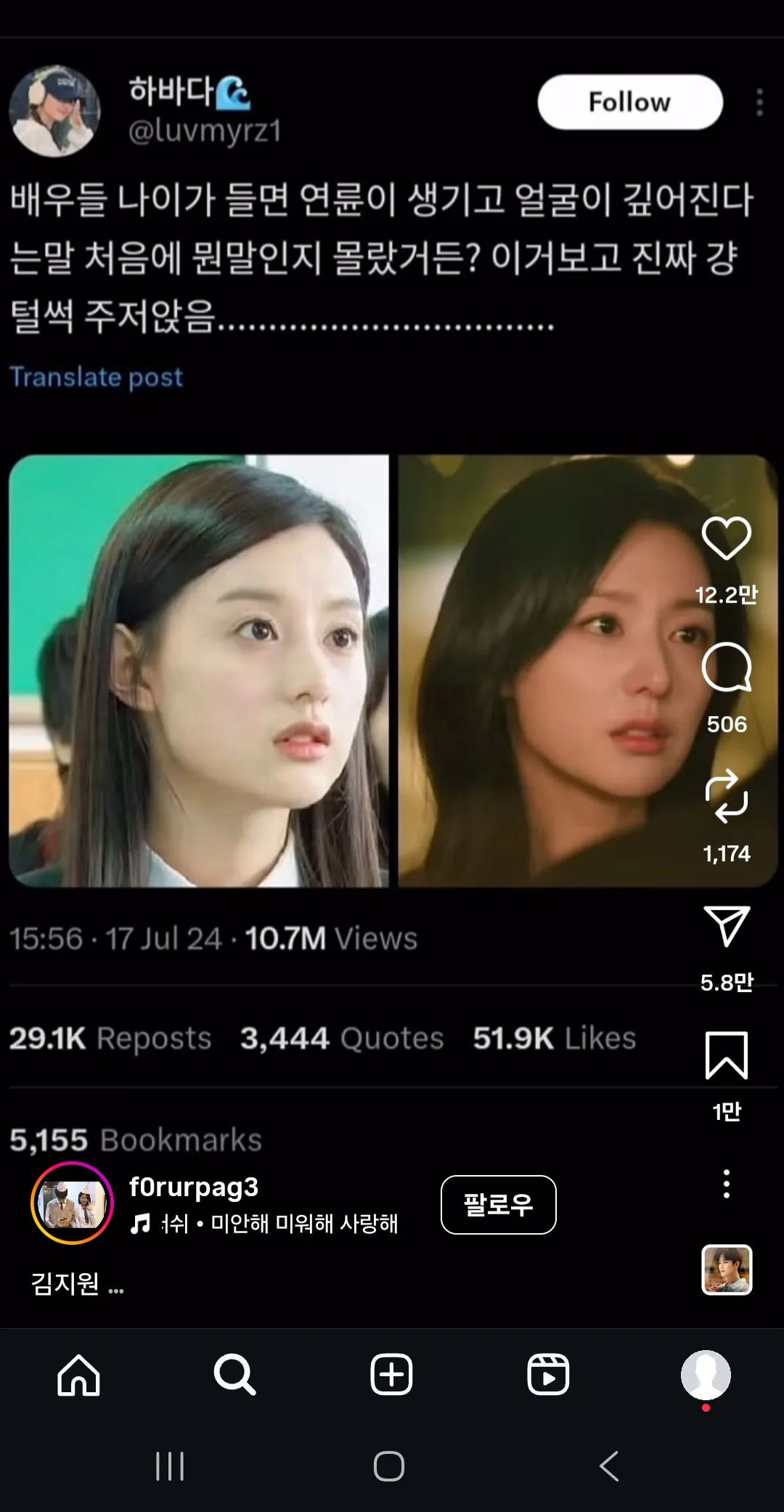 지금 왼쪽 김지원 비슷한 상태인데