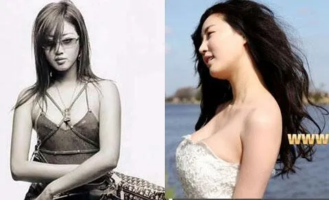 김사랑이 가슴수술 ㄹㅇ자연스럽게잘됨