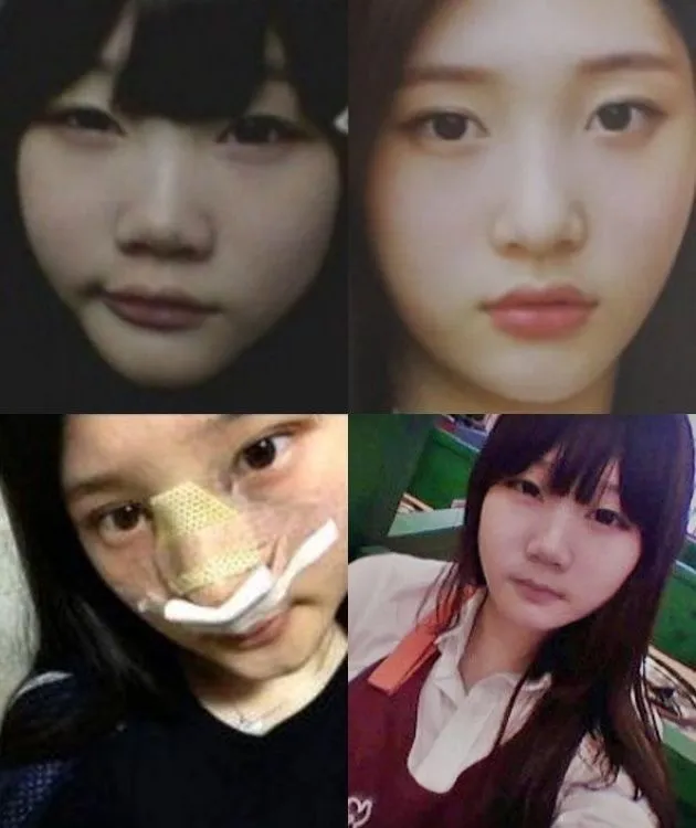 헐