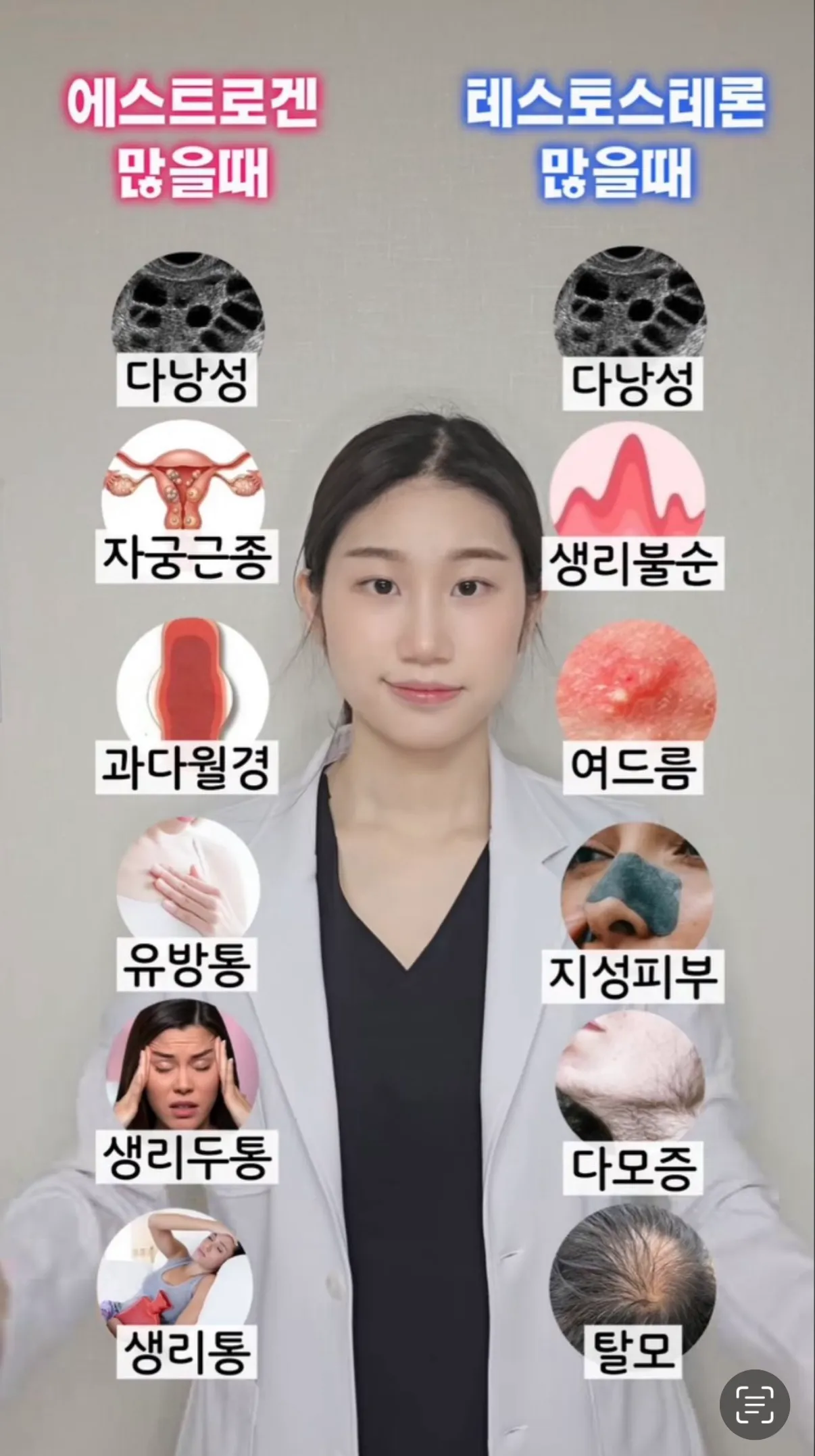 테토인지 에겐인지 알아보는법