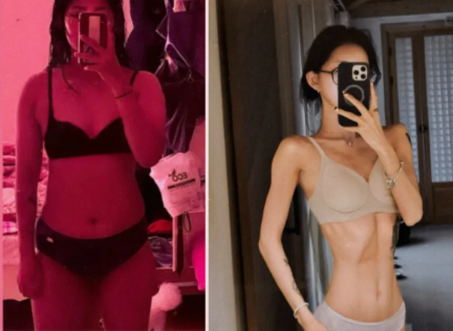 얘는 진짜 굶어서빼는거죠?170에413