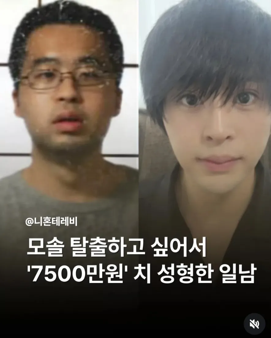 모솔 탈출하고싶어서 성형한 일남