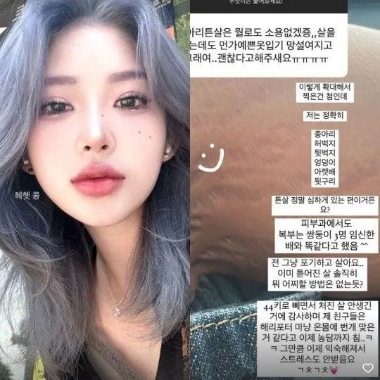 튼살은 연예인들도 못고치나봐요...2