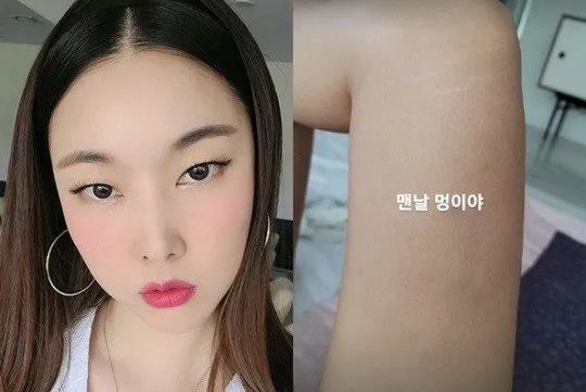 튼살은 연예인들도 못고치나봐요...4