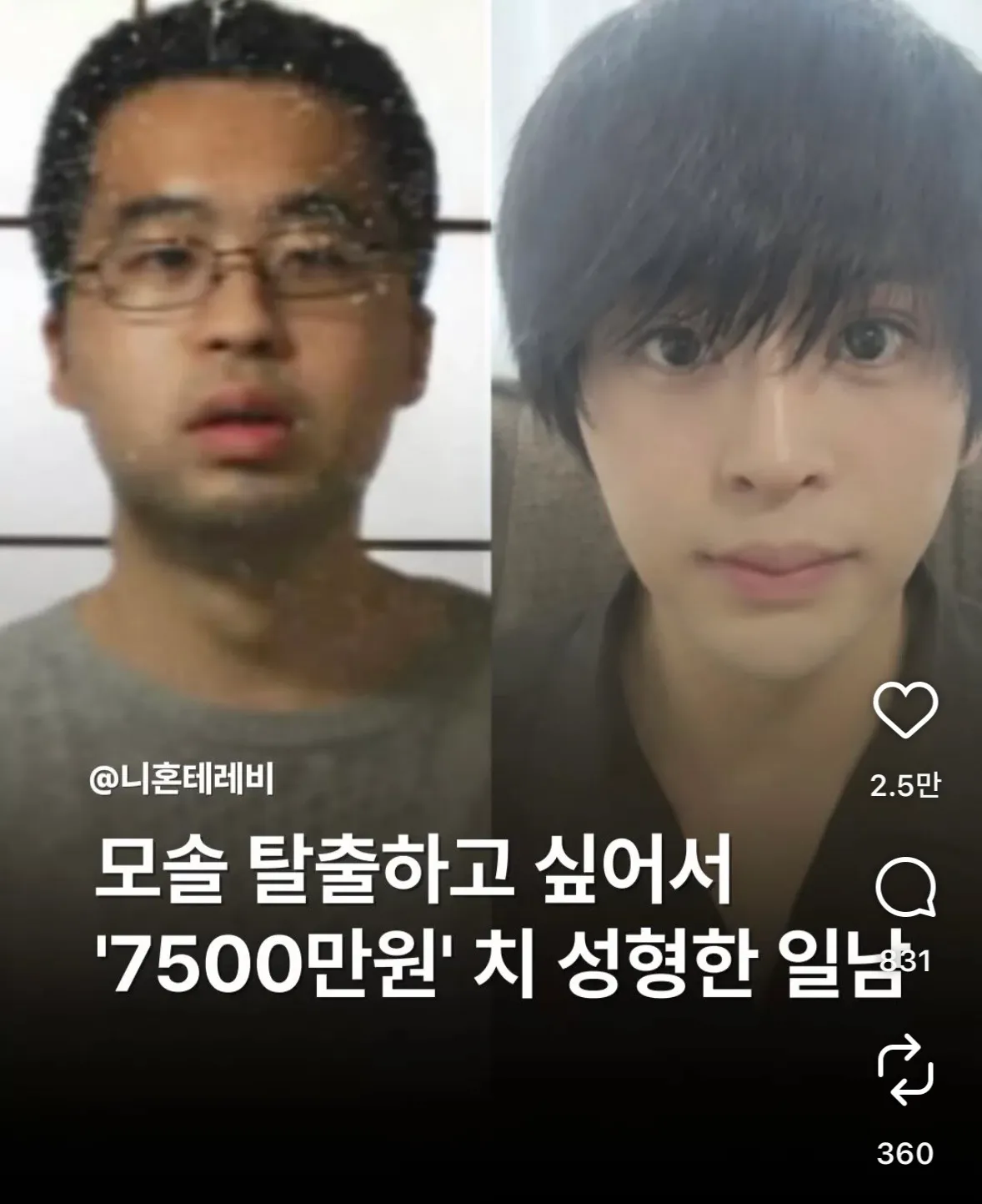 한남도 제발 성형해라 ㅅㅂ