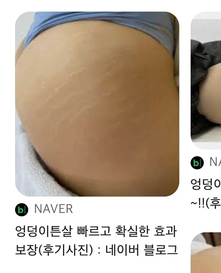 ㅅㅂ조현병년한테 낚임