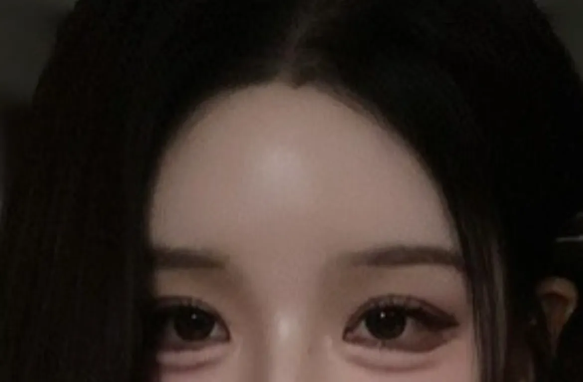 뒤밑트할까요