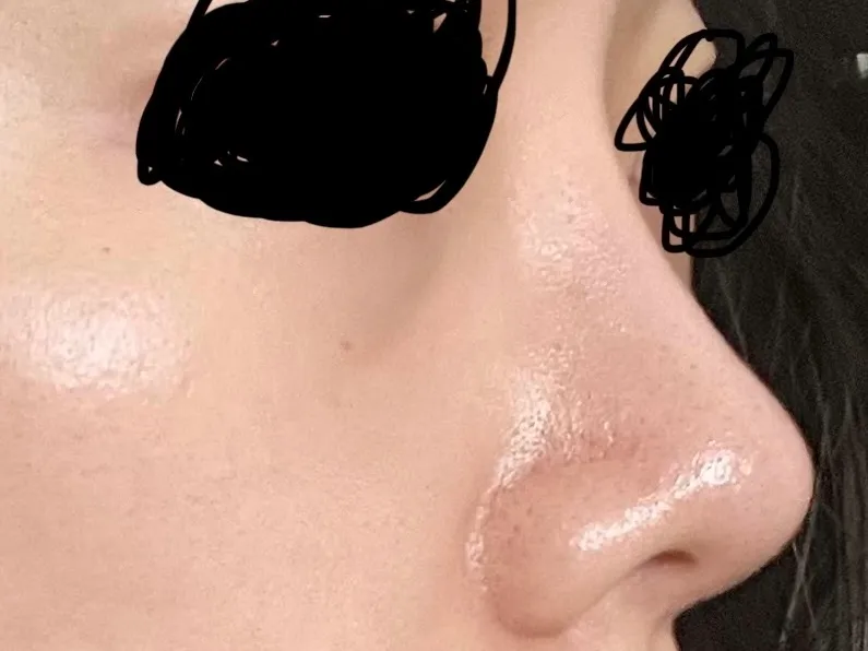 저 코 다시할까여 ㅠ