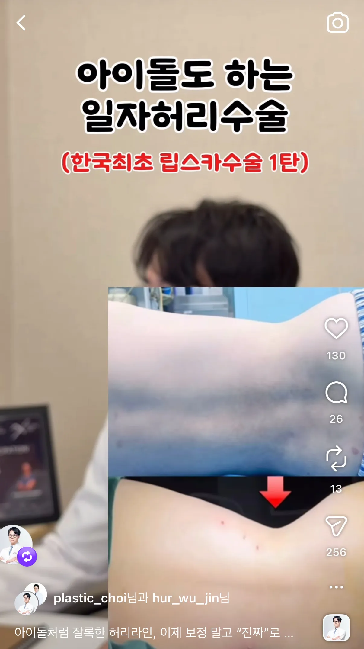 언니들 이 성형어때요