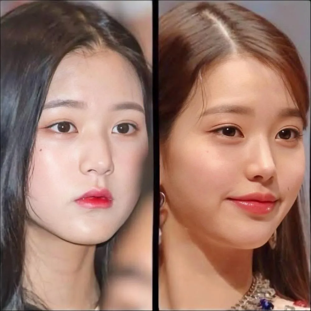 수술 뭐했을까