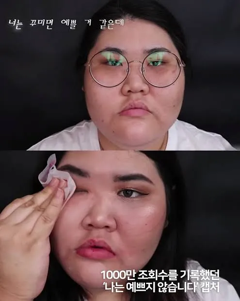 남자 쌍수 레전드2