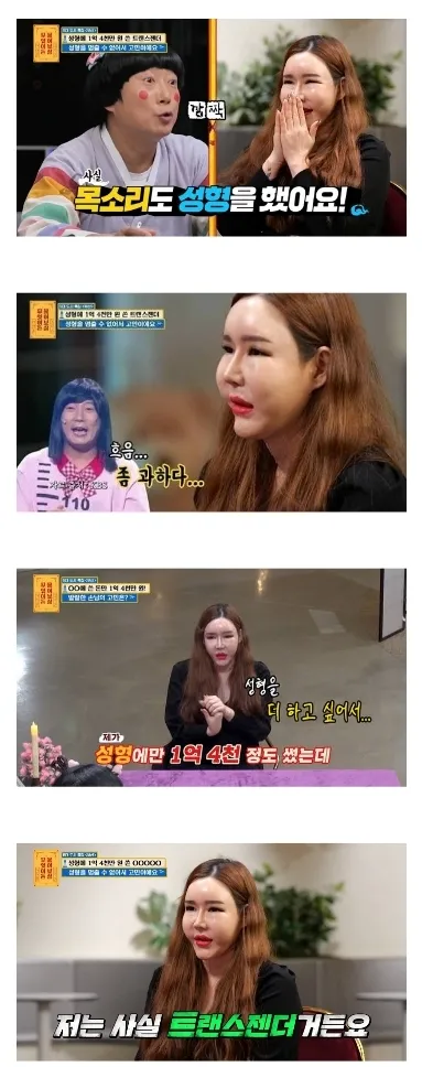 성형에 1억 4000쓴 트젠..