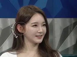 한쪽 귀 까야하는 얼굴 특징 뭘까요2