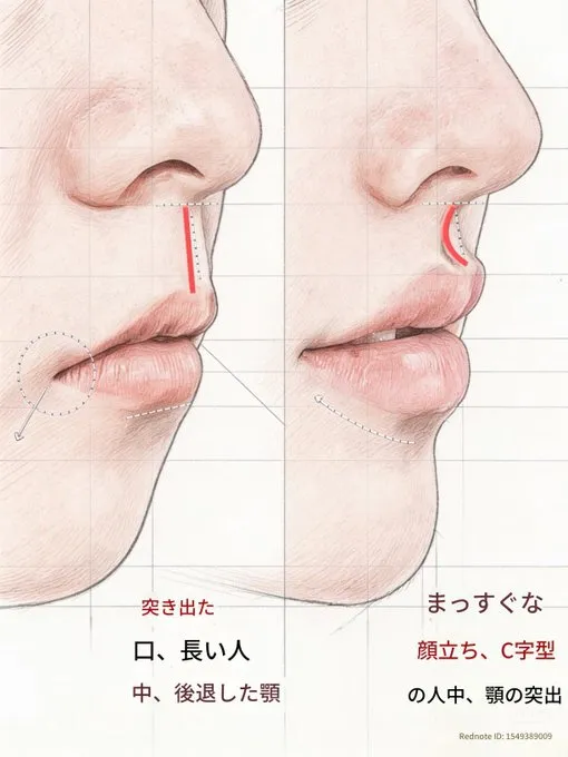 저도 요새 인중 정병 오져요2
