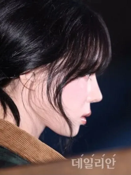 저도 요새 인중 정병 오져요3